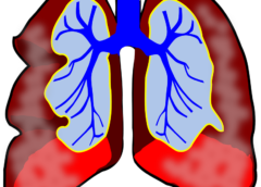lung